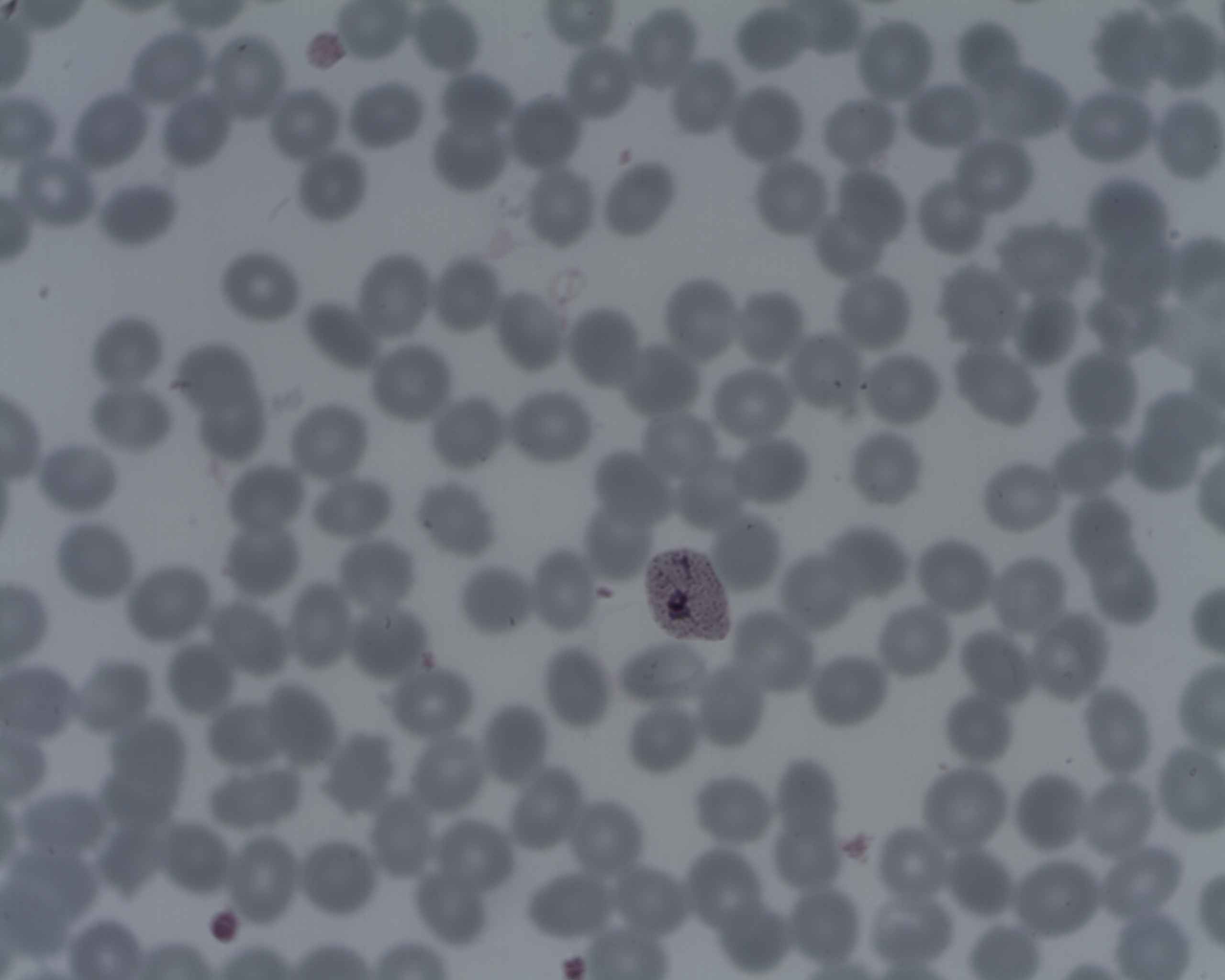 Plasmodium vivax