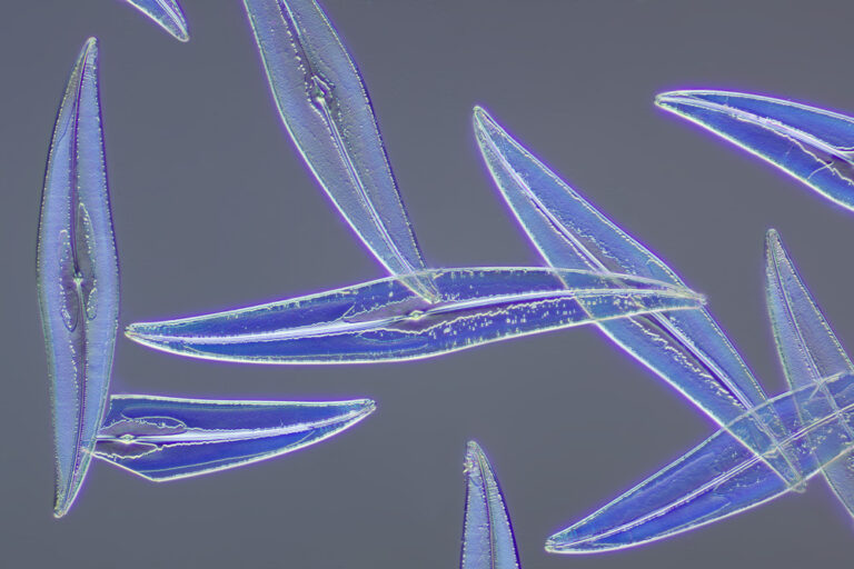 Pleurosigma angulatum
