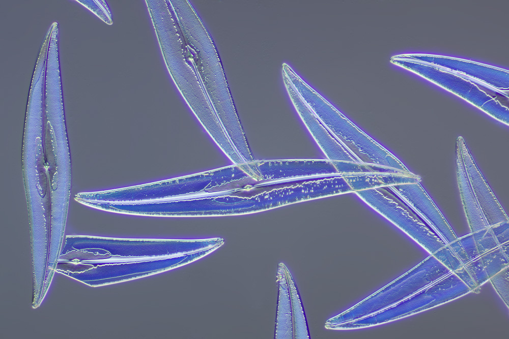 Pleurosigma angulatum