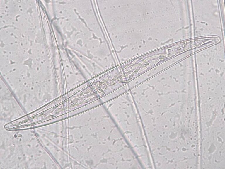 Pleurosigma elongatum Pleurosigma elongatum