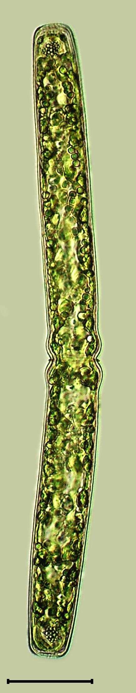 Pleurotaenium trabecula Pleurotaenium trabecula