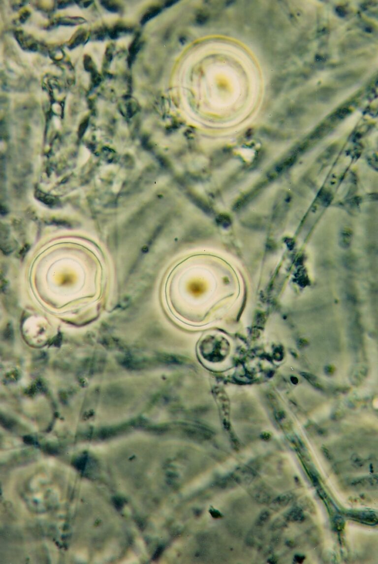 plíseň kokosová (Phytophthora palmivora)
