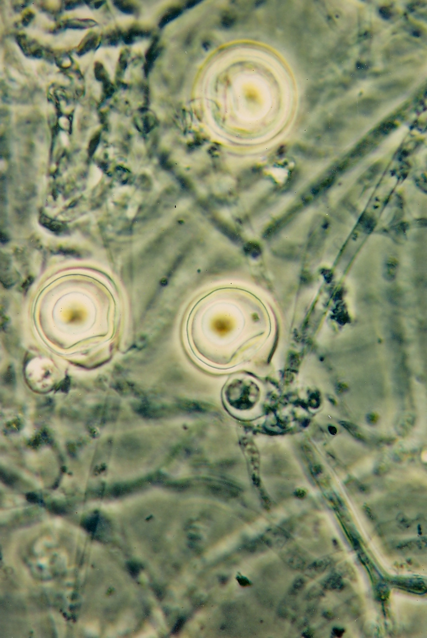 plíseň kokosová (Phytophthora palmivora)
