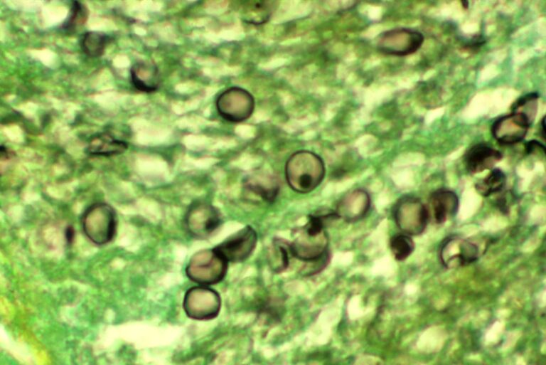 Pneumocystis jirovecii Pneumocystis jirovecii