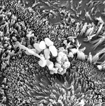 Propionibacterium freudenreichii
