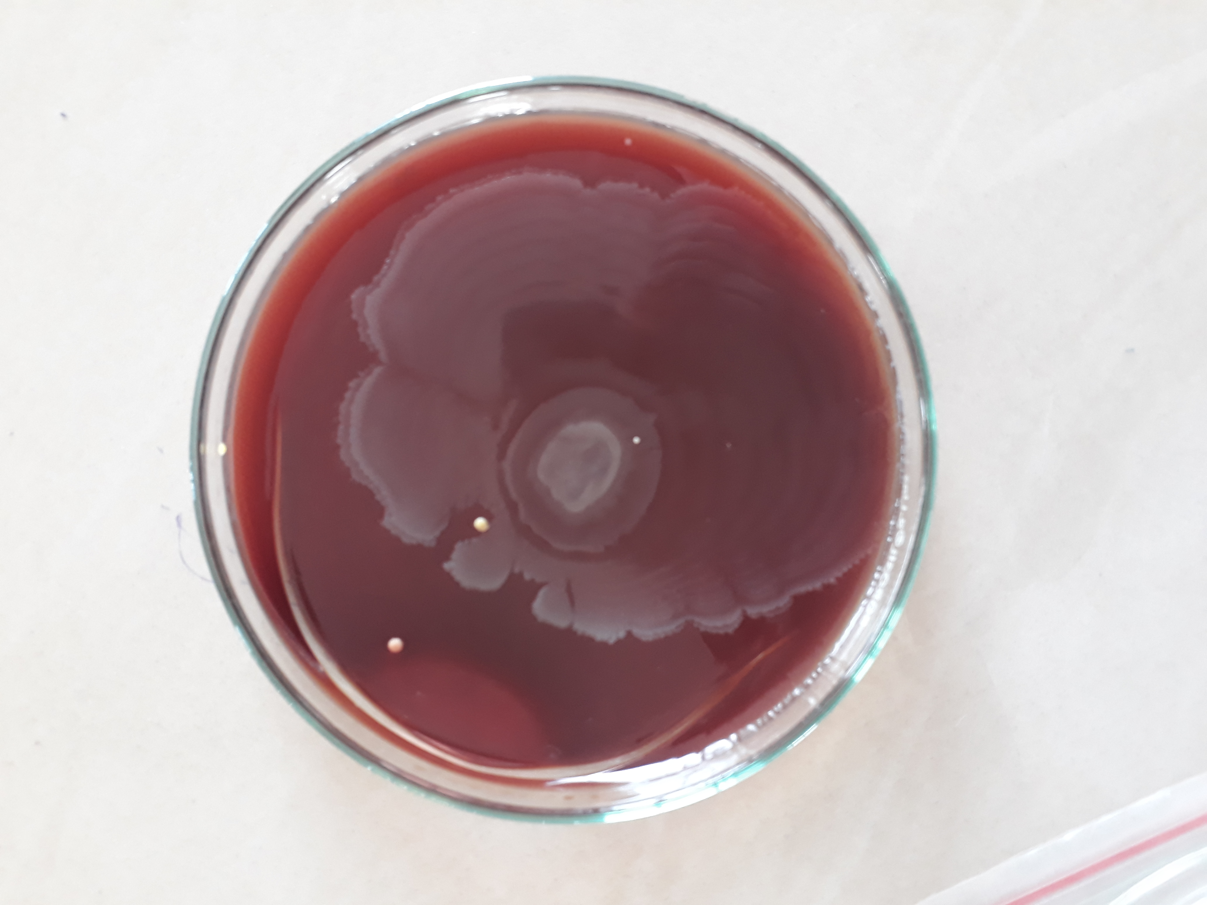 Proteus mirabilis