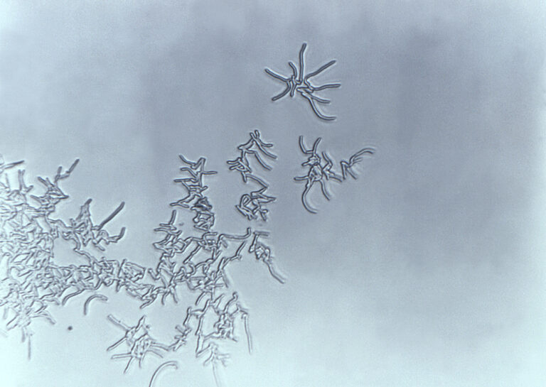 Rhodococcus (Rhodococcus)