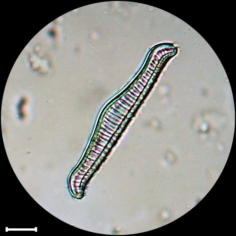 Rhopalodia gibba