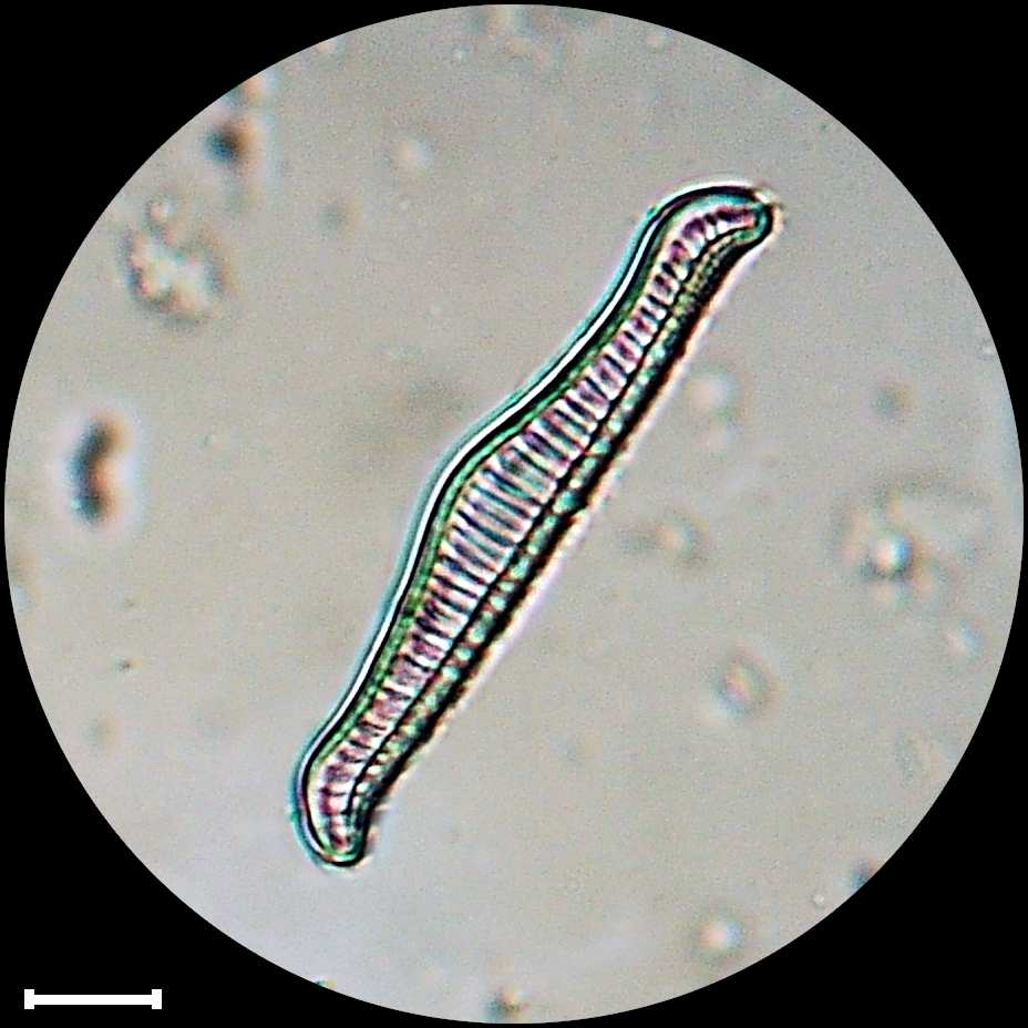Rhopalodia gibba