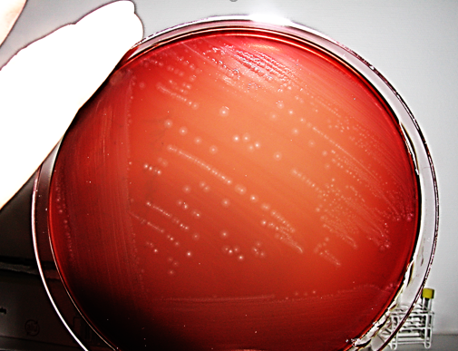 Roseburia intestinalis