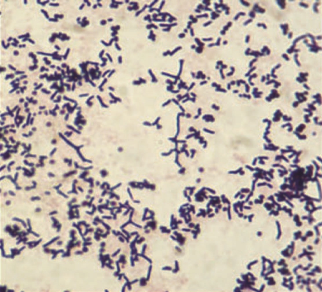 Rothia dentocariosa