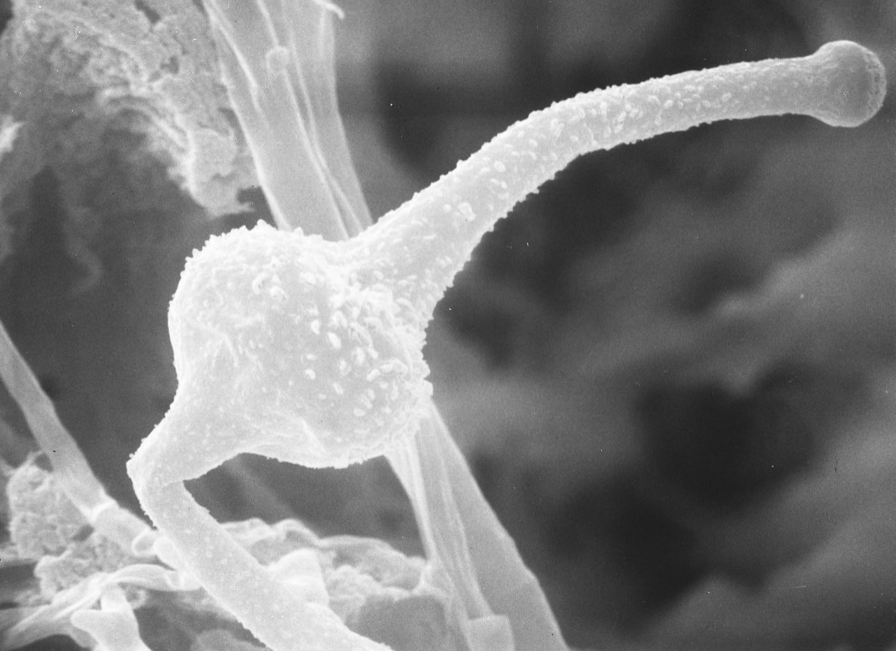 Saksenaea vasiformis