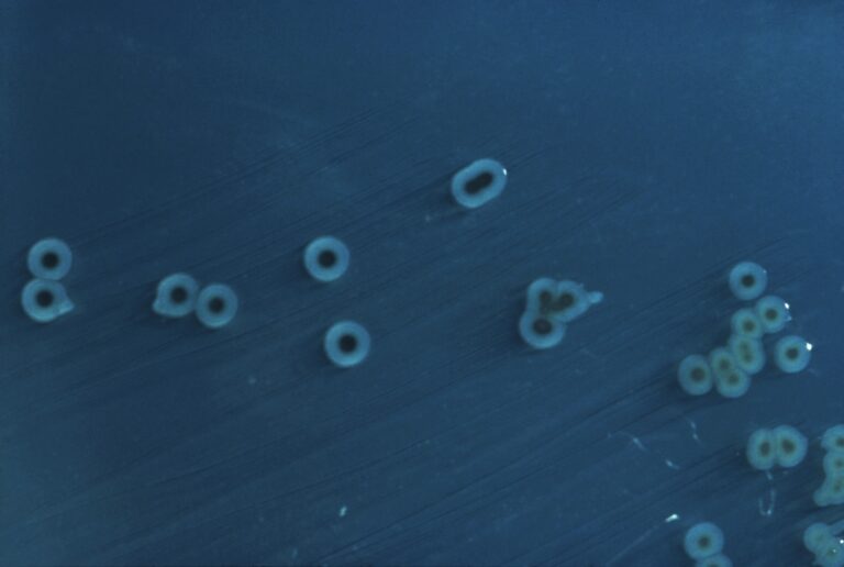 Salmonella enterica