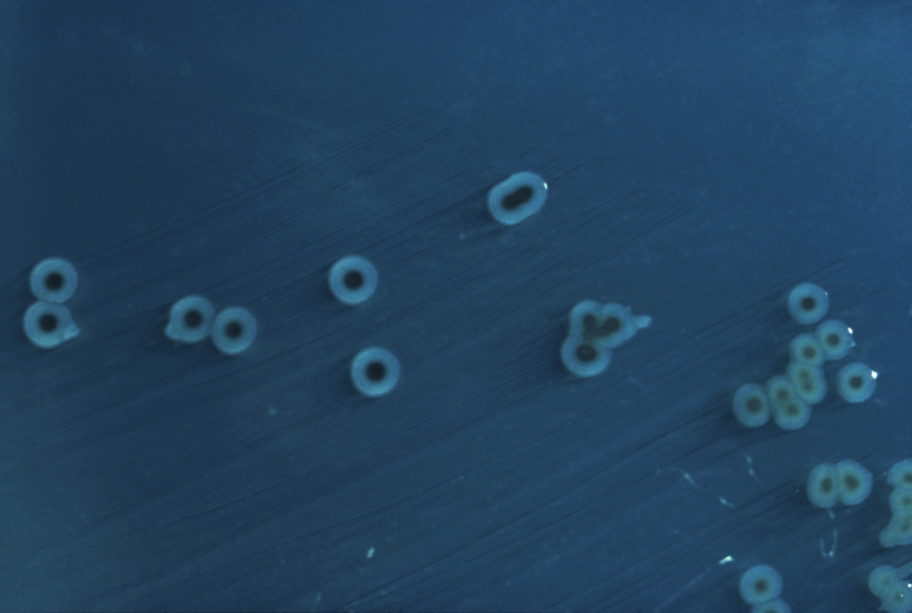 Salmonella enterica