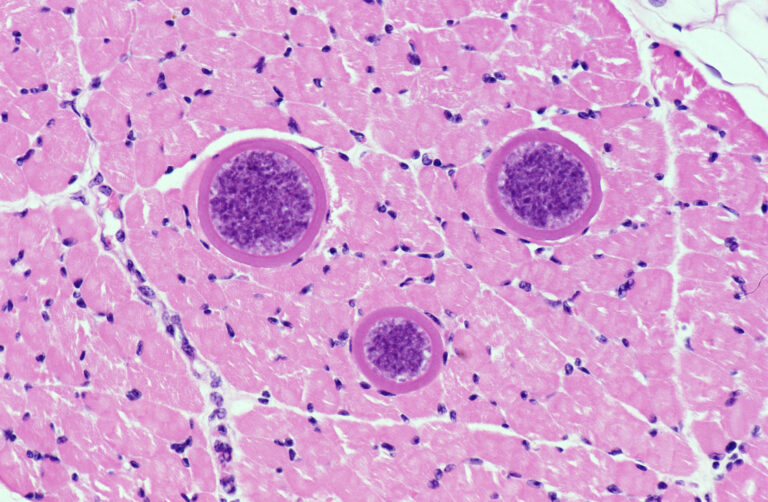 Sarcocystis hominis