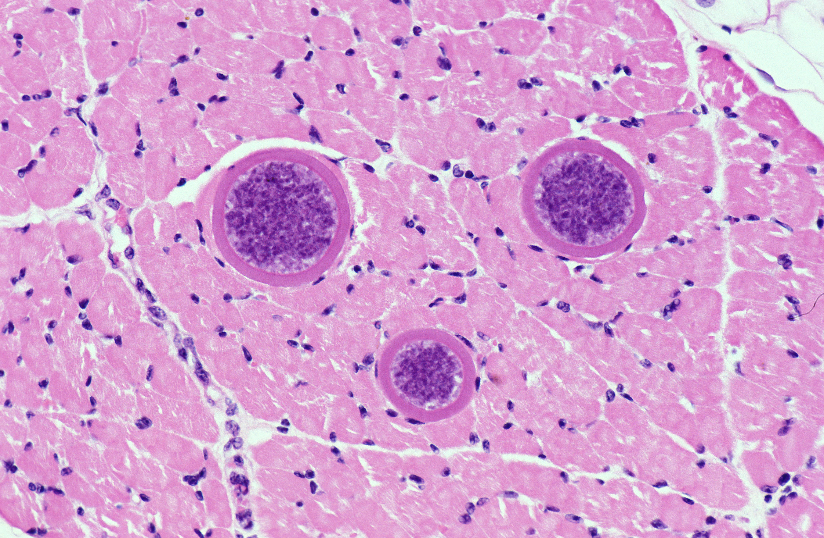 Sarcocystis hominis