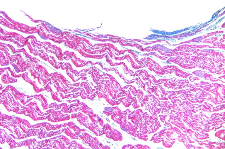 Sarcocystis tenella Sarcocystis tenella