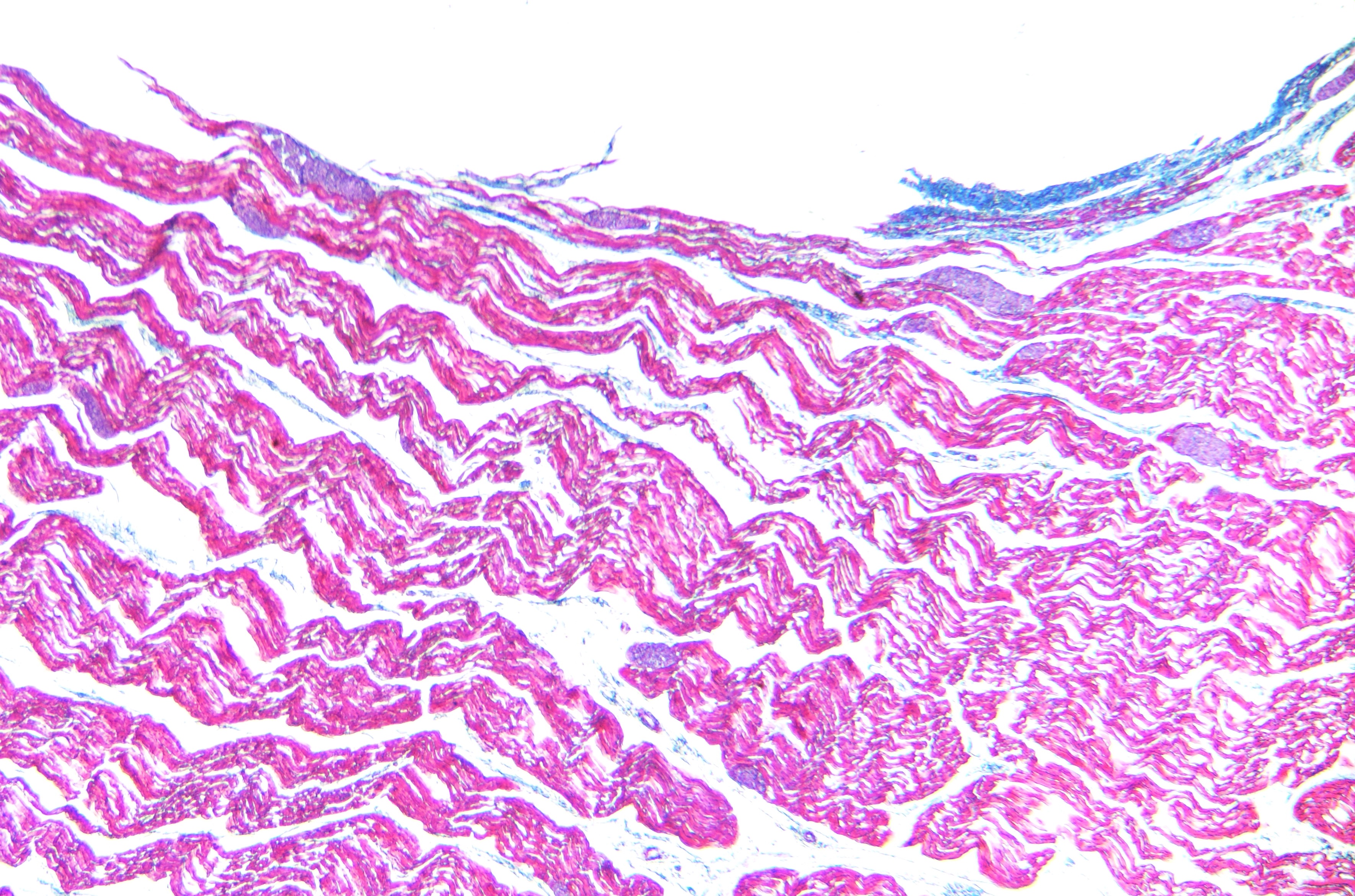 Sarcocystis tenella