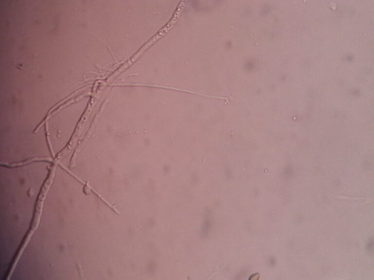 Scedosporium apiospermum