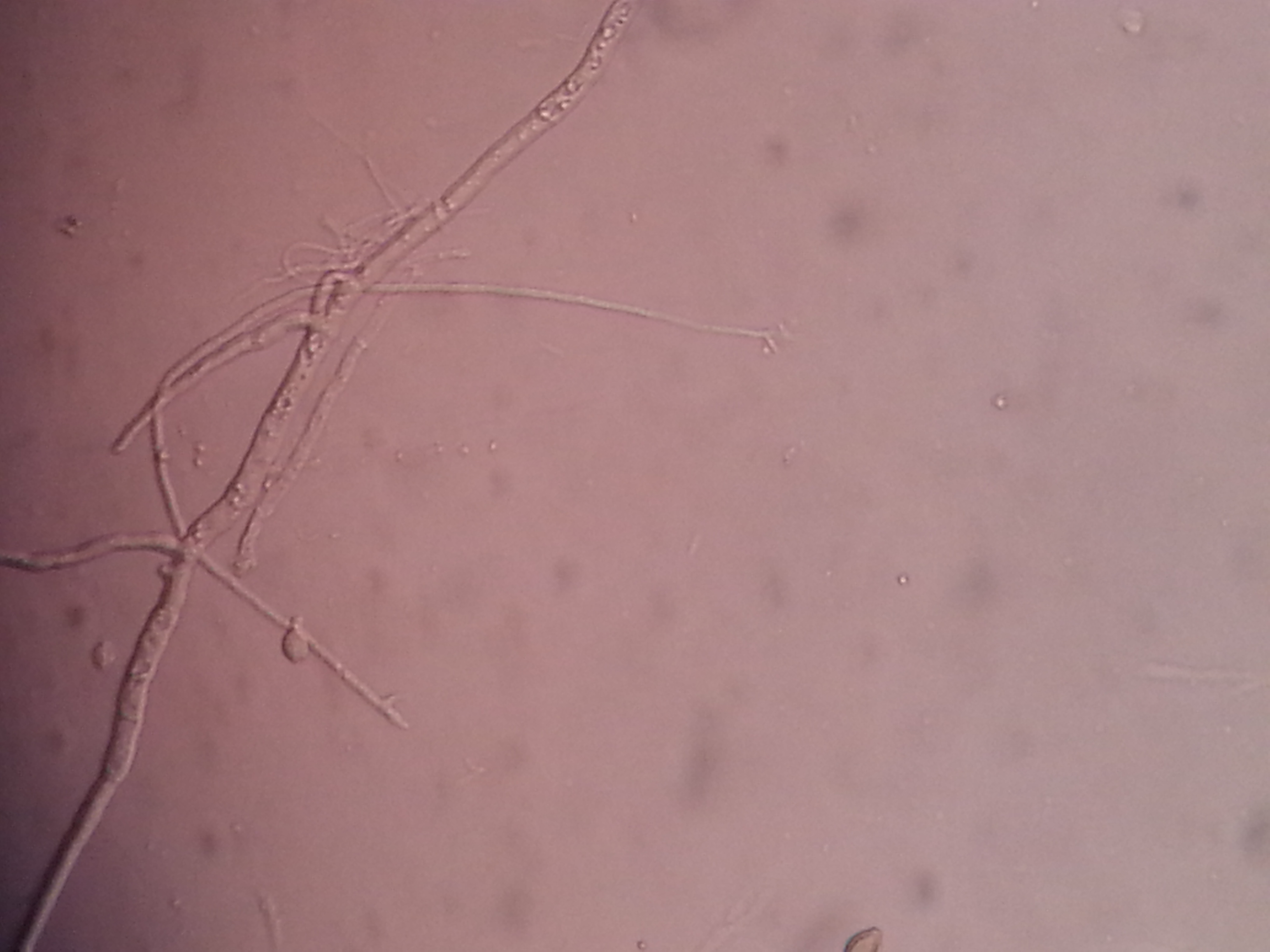 Scedosporium apiospermum
