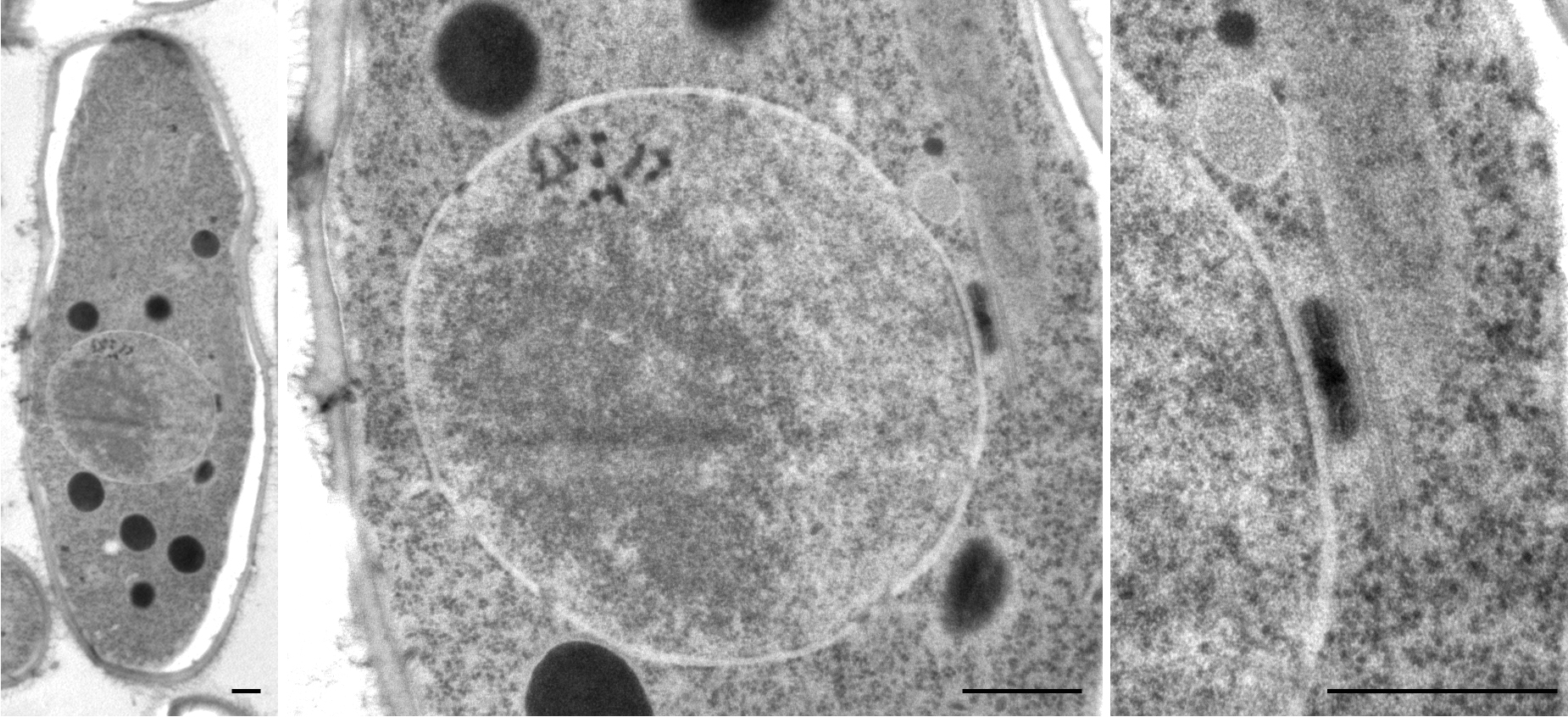 Schizosaccharomyces pombe