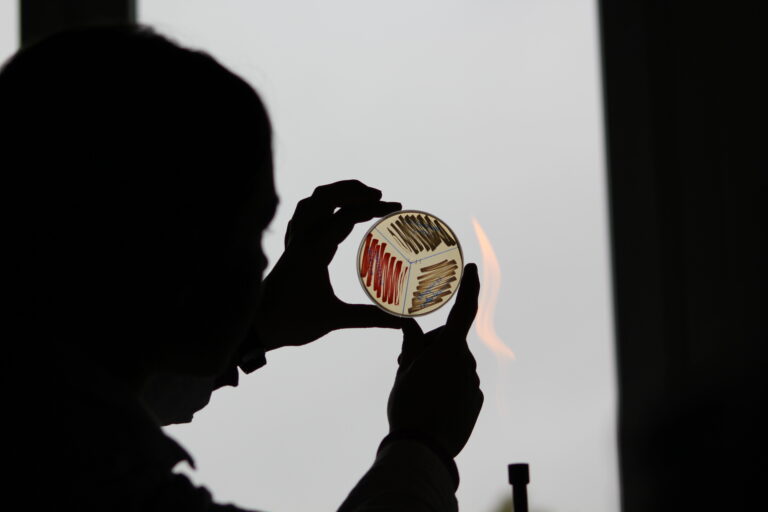 Serratia marcescens Serratia marcescens