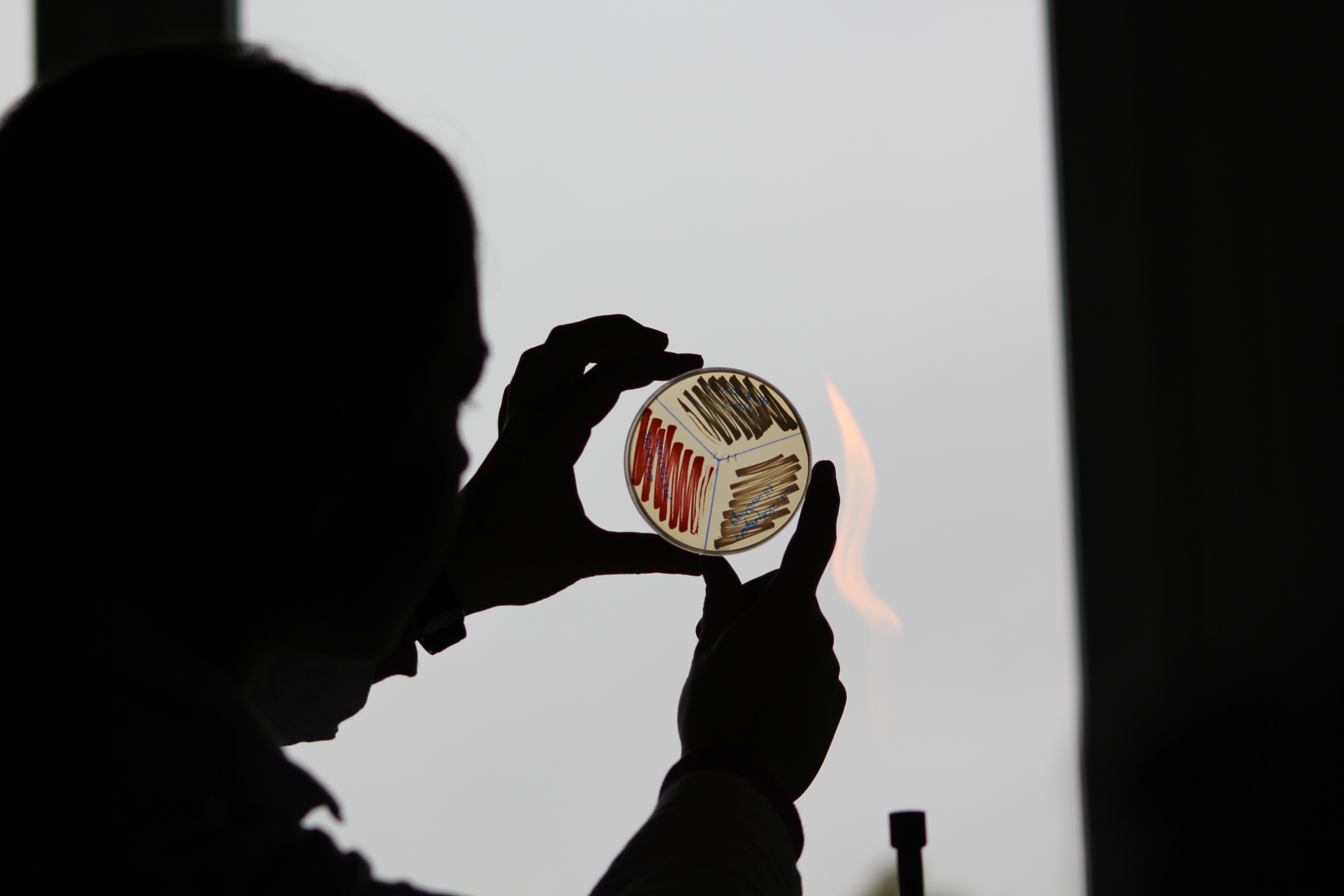 Serratia marcescens