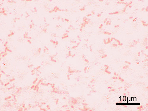 Shigella flexneri
