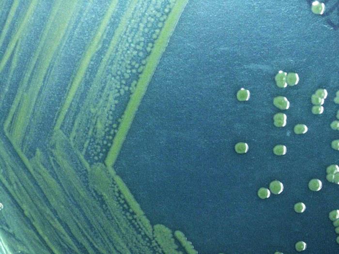 Shigella sonnei