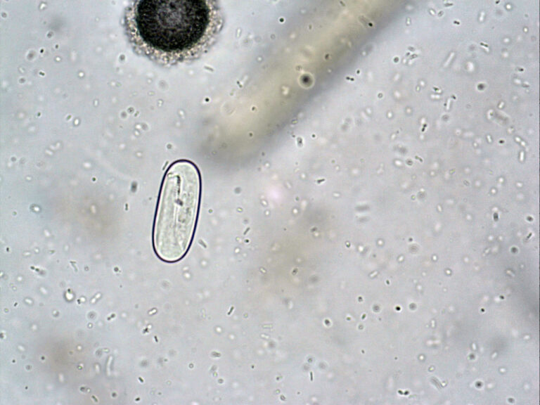 Spirocerca lupi