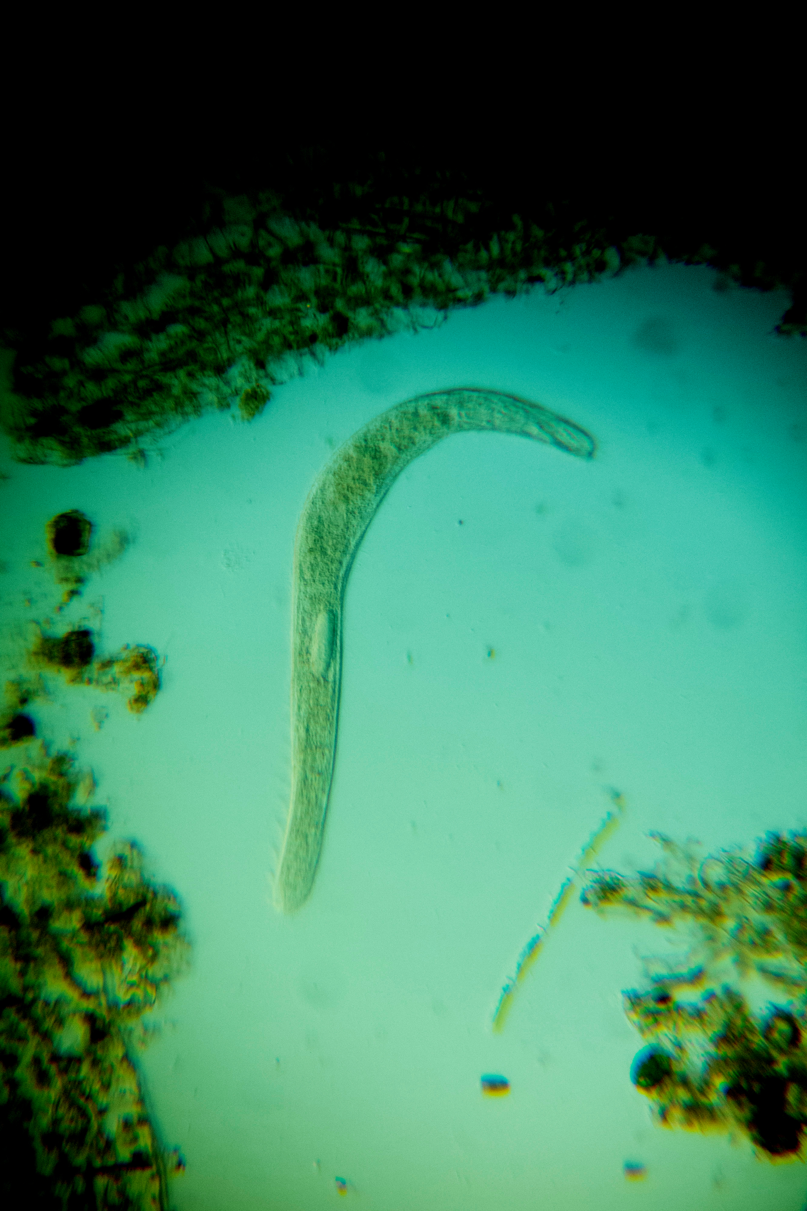 Spirostomum teres