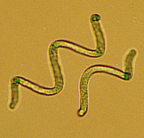 Spirulina (Spirulina)