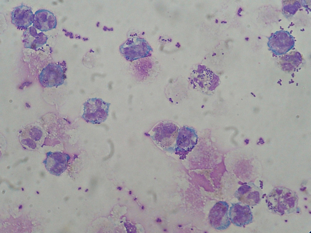 Staphylococcus capitis