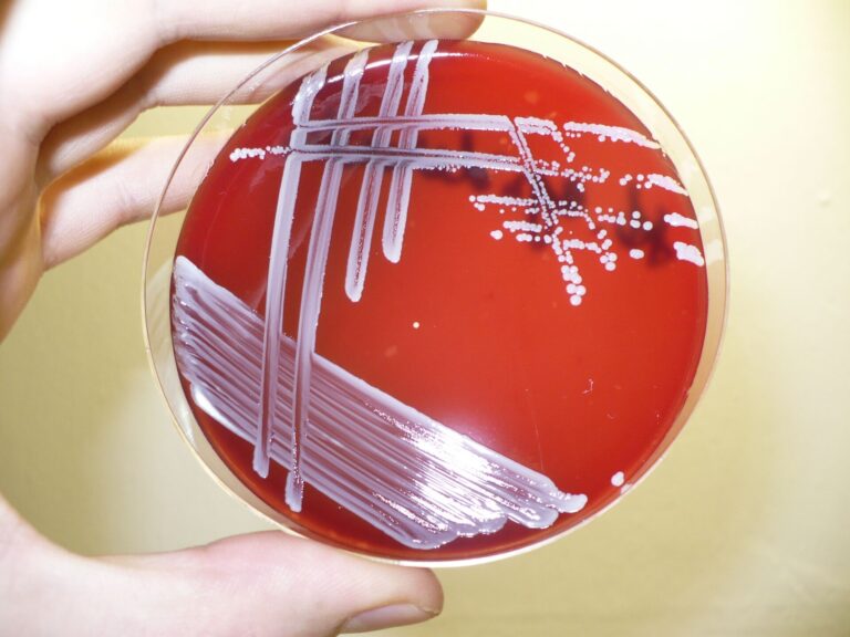 Staphylococcus epidermidis Staphylococcus epidermidis