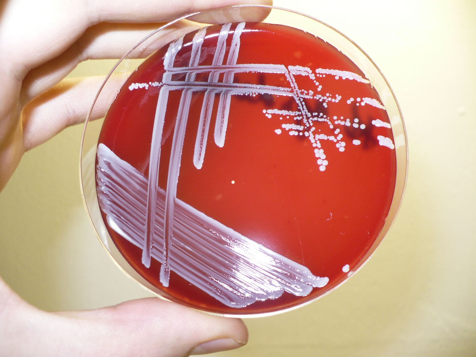 Staphylococcus epidermidis