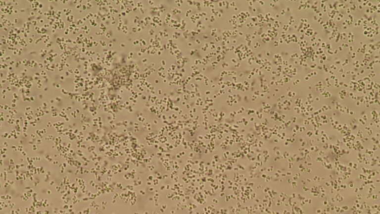 Staphylococcus haemolyticus