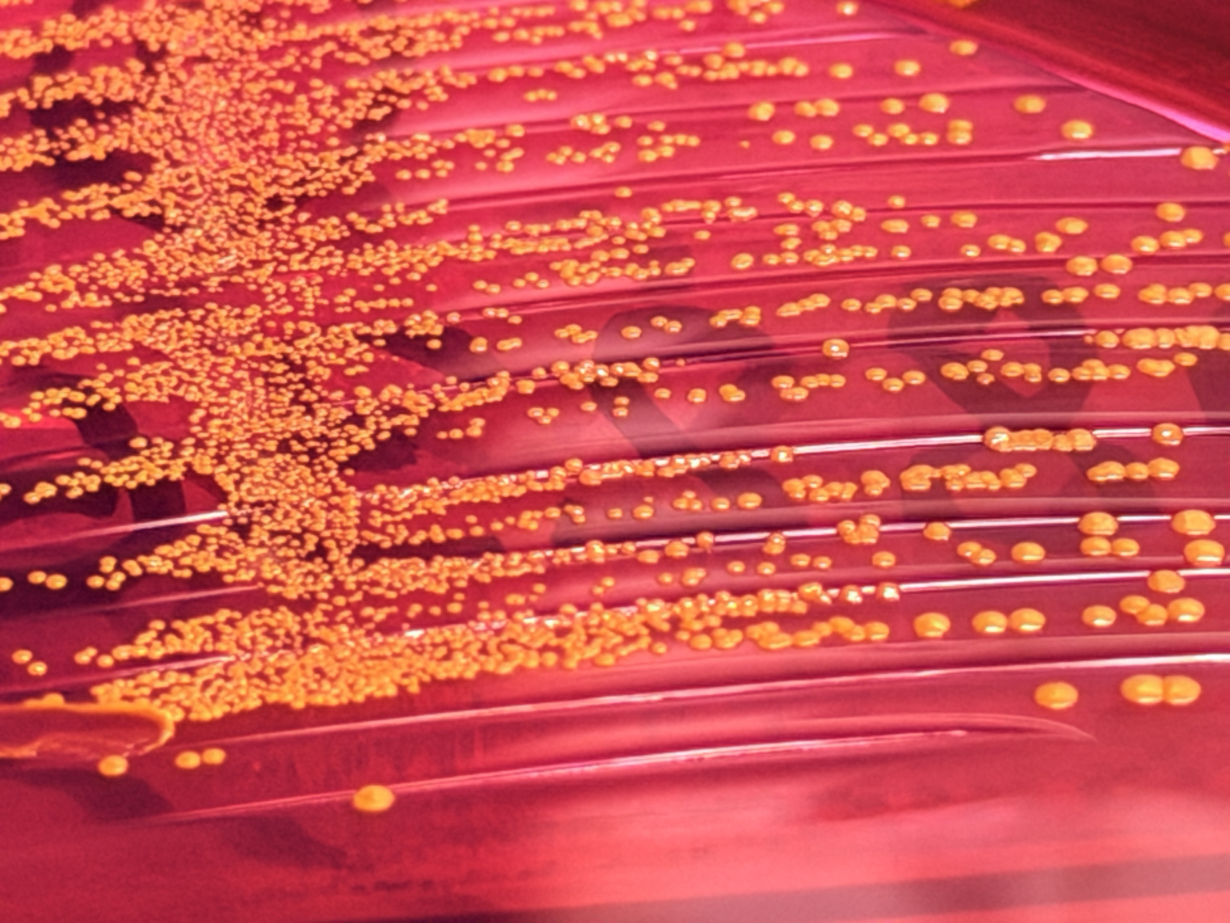Staphylococcus hominis