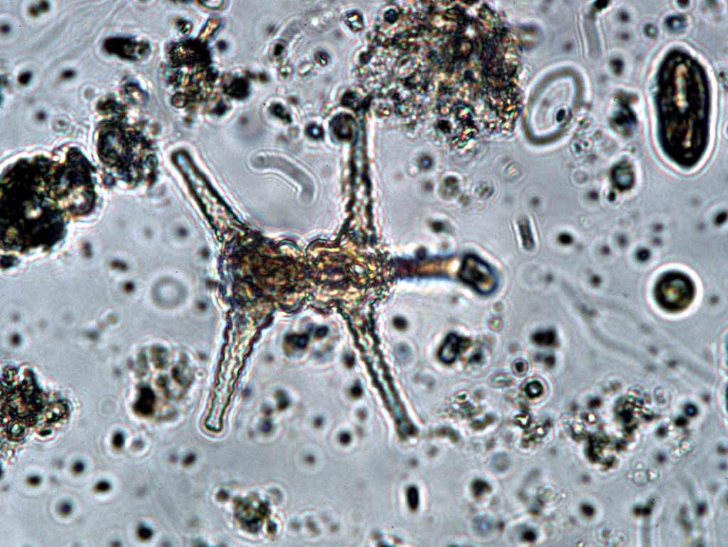 Staurastrum paradoxum