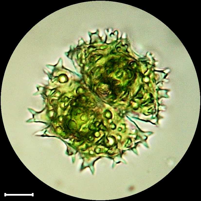 Staurastrum spongiosum