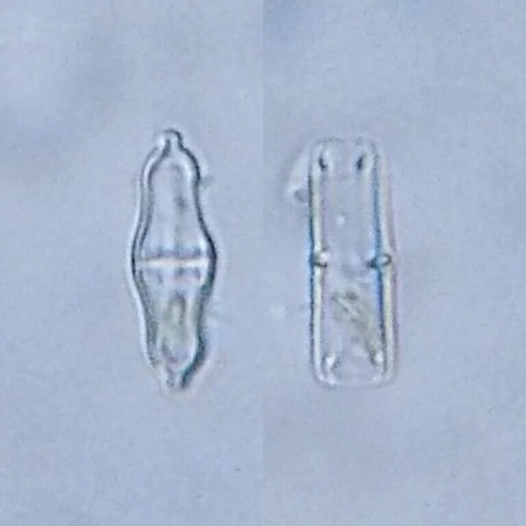 Stauroneis smithii Stauroneis smithii