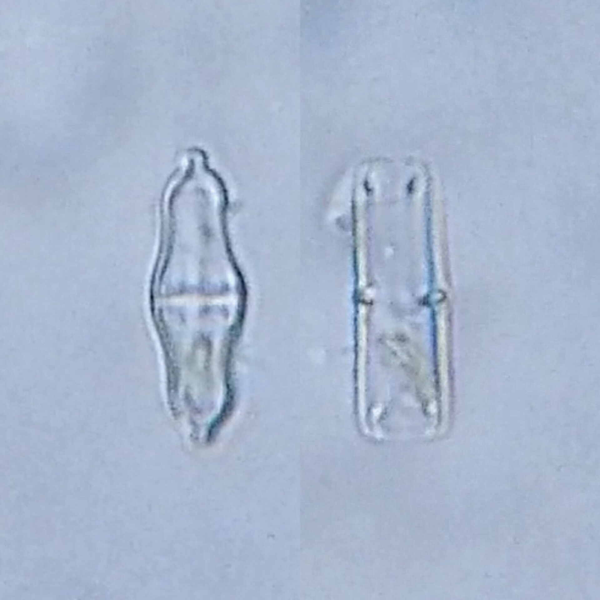 Stauroneis smithii