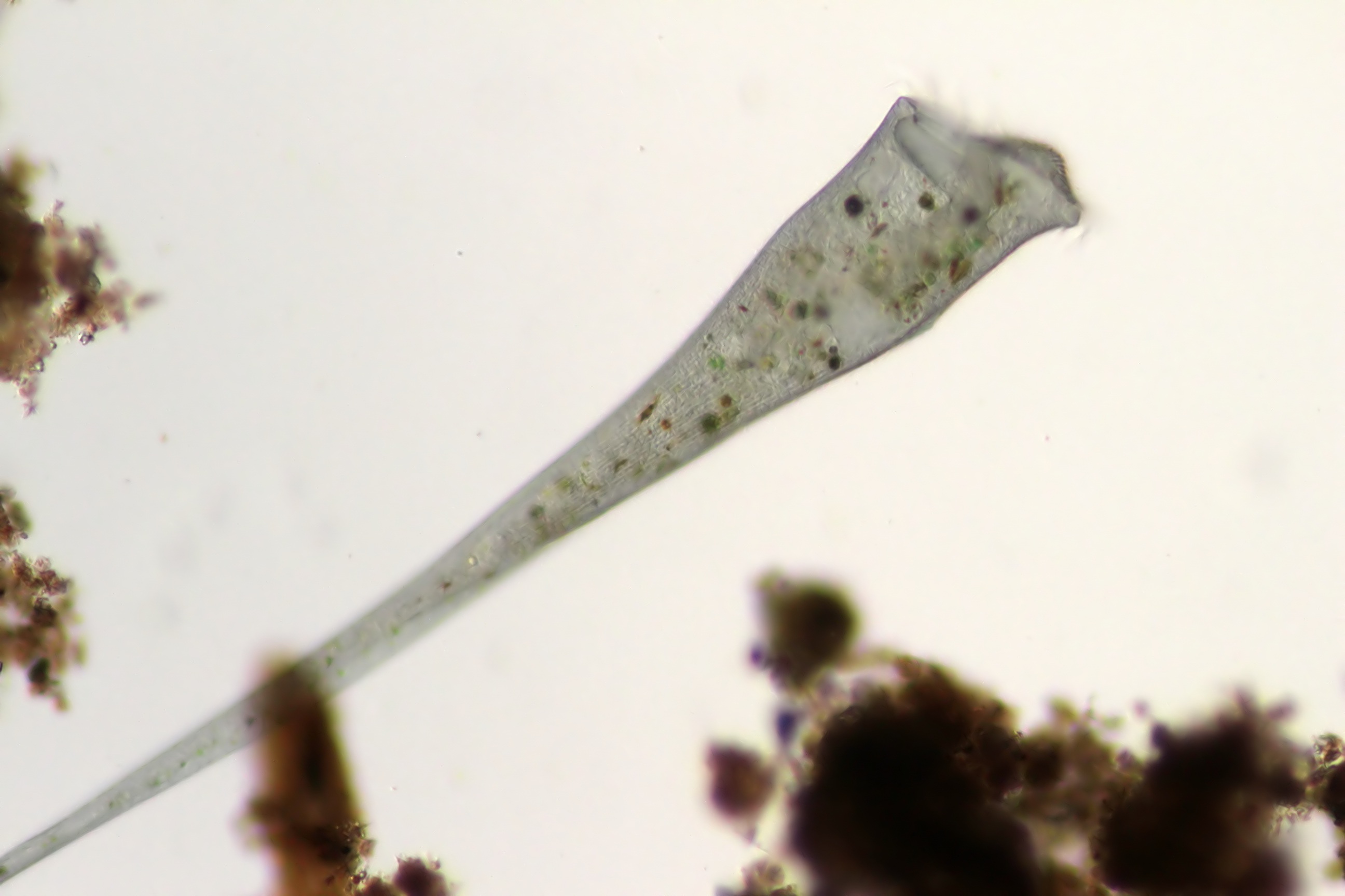 Stentor coeruleus