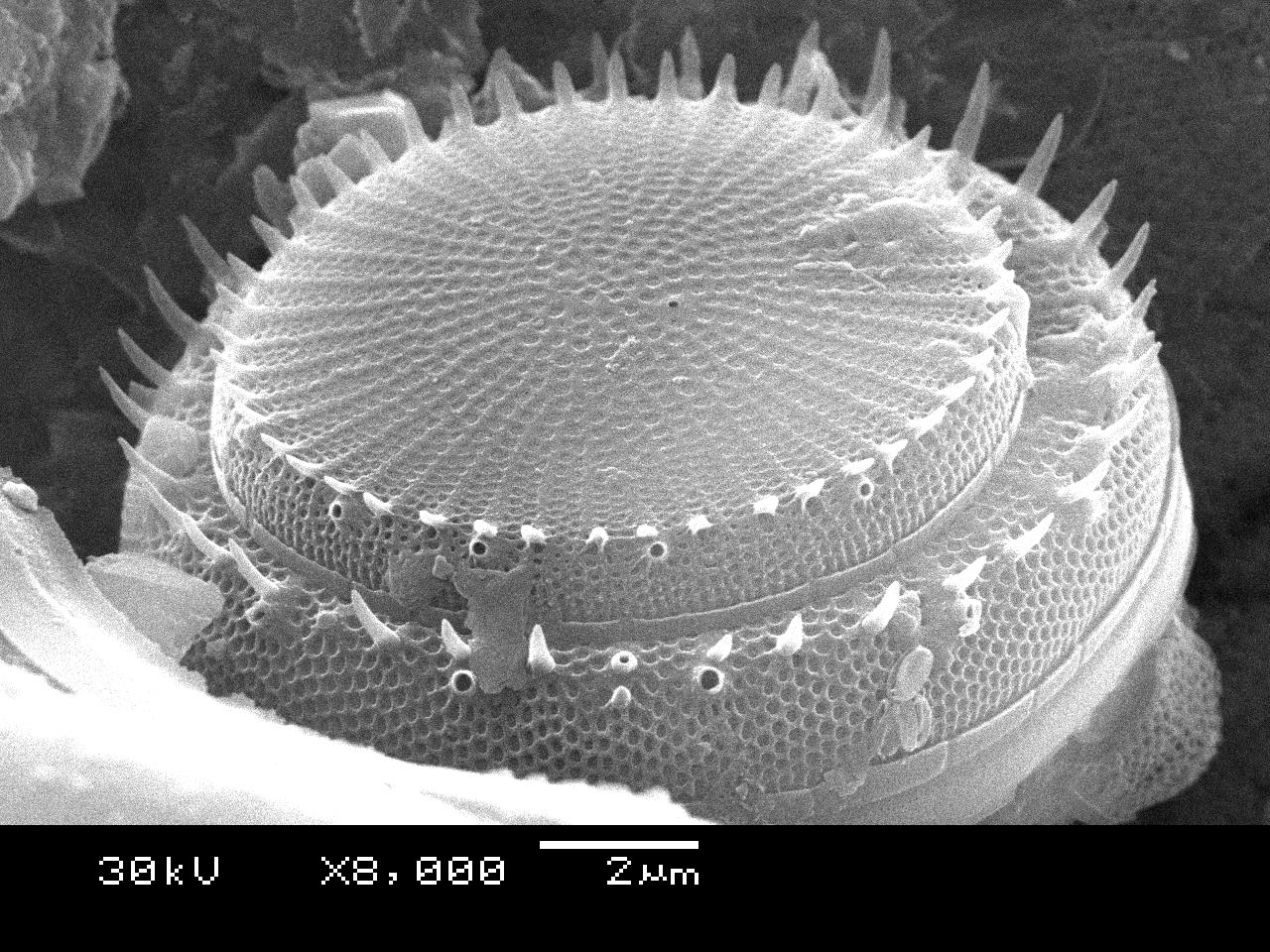 Stephanodiscus hantzschii