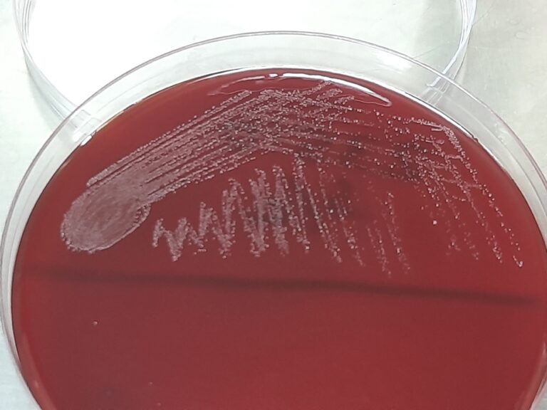 Streptococcus agalactiae Streptococcus agalactiae