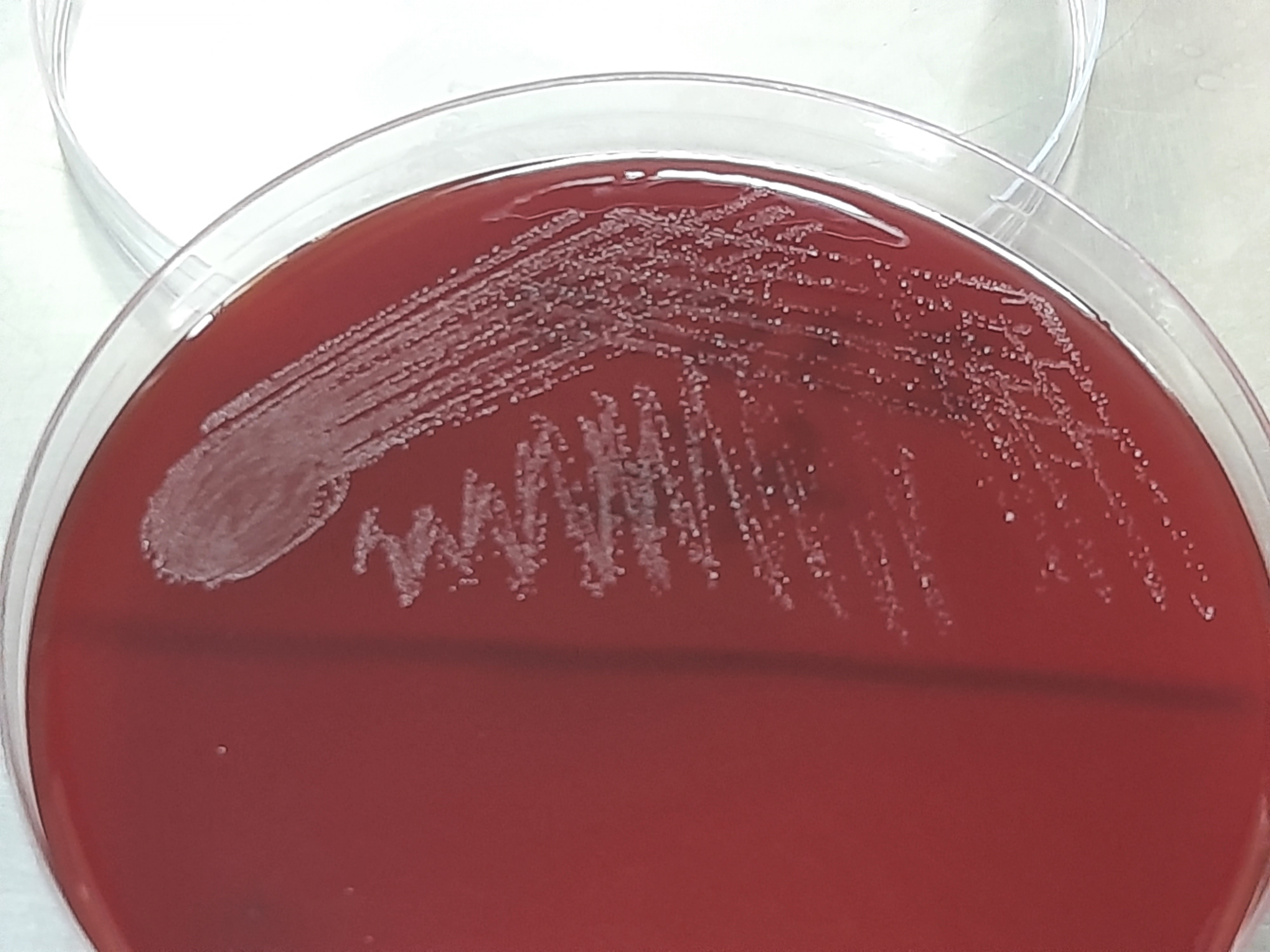 Streptococcus agalactiae