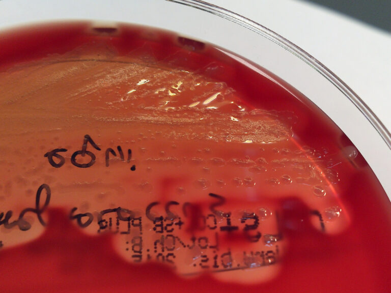 Streptococcus equi