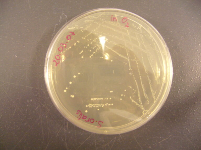 Streptococcus oralis