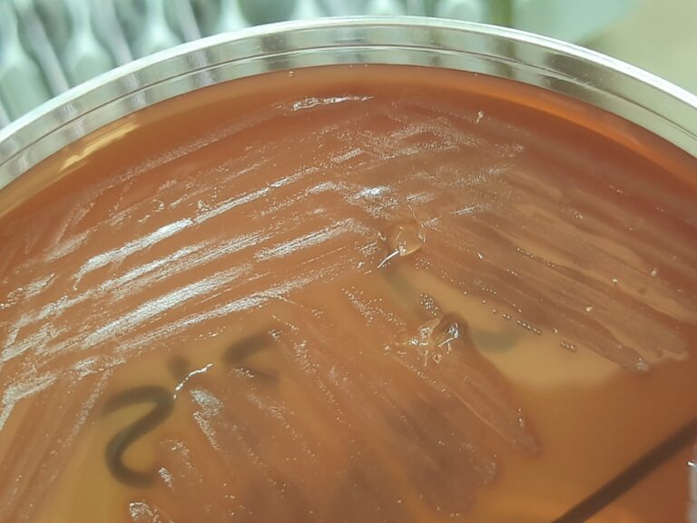 Streptococcus sanguinis