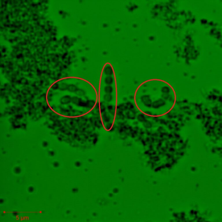Streptococcus thermophilus