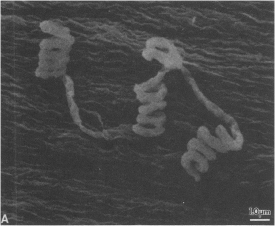 Streptomyces avermitilis